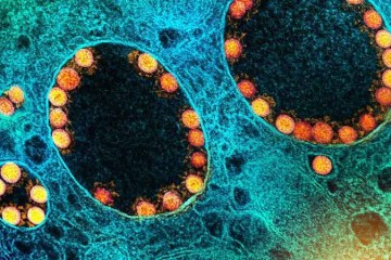 As primeiras análises apontam que a nova cepa tem a capacidade de “driblar” o bloqueio imunológico